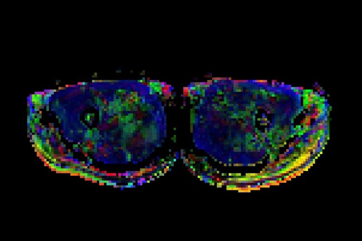 Multiparametrische Muskelbildgebung